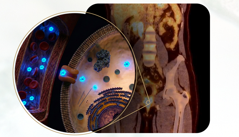 Imagem aproximada de radioisótopos visualizados no PET-CT